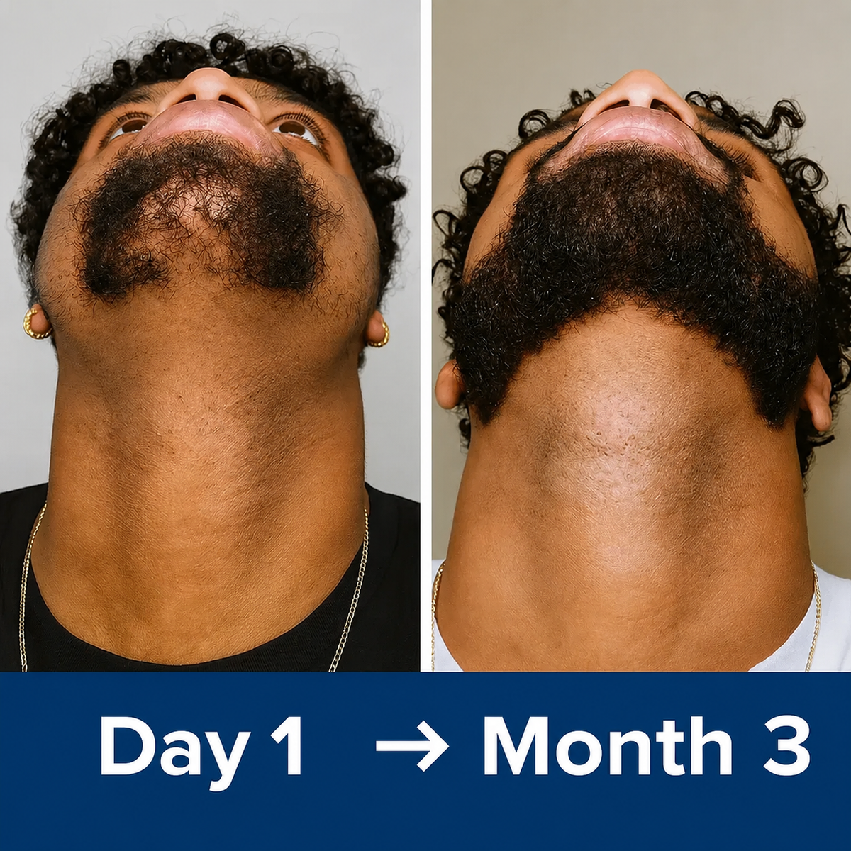 Beard appearance from day 1 to month 3 of a consistent care routine